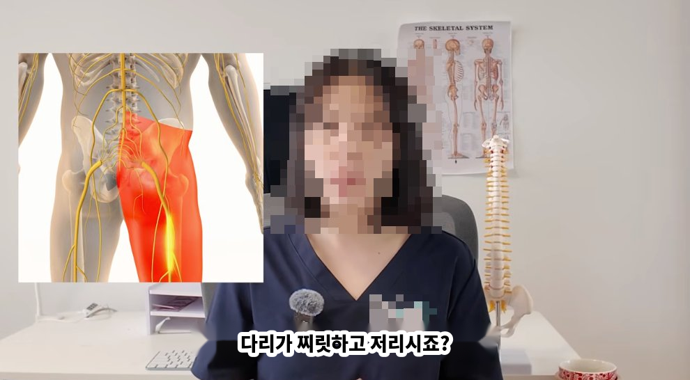 기존 홈페이지의 모자이크 처리된 전문직 고객 원본 사진